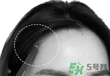 發(fā)際線高適合什么發(fā)型？發(fā)際線高怎么辦