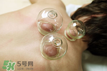 拔罐放血會得傳染病么？拔罐放血會傳染疾病嗎？