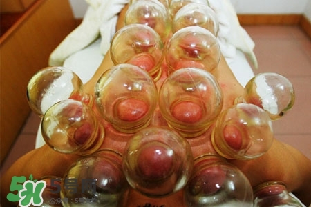 拔罐放血能治皮膚病嗎？拔罐放血能治牛皮癬嗎？