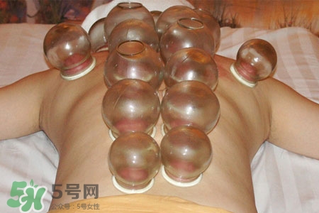 拔罐分季節(jié)嗎？不同季節(jié)的拔罐禁忌