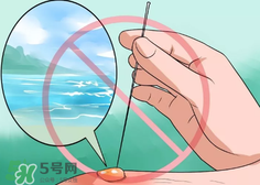 水泡怎么處理？水泡要不要刺破？