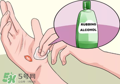 水泡怎么處理？水泡要不要刺破？