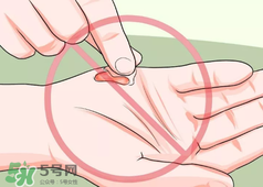 水泡怎么處理？水泡要不要刺破？