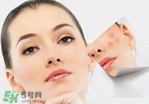 封閉性粉刺會(huì)自己消失嗎？封閉性粉刺好了會(huì)留疤嗎？