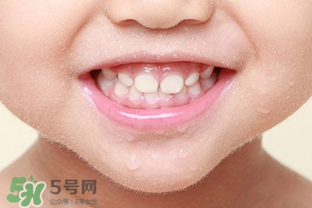 刷牙后吃東西發(fā)苦正常嗎？為什么刷牙后吃東西發(fā)苦？