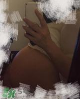 預(yù)防妊娠紋用什么好？懷孕期間如何預(yù)防妊娠紋