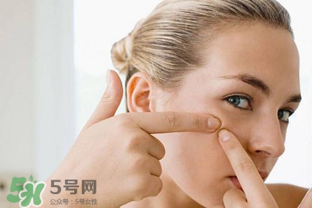 春天臉上冒痘痘怎么辦？為什么春天臉上容易出痘？