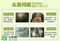 牛角梳梳頭可以生發(fā)嗎？牛角梳怎么梳頭？