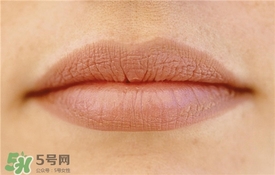卡唇紋是什么意思？卡唇紋怎么辦？