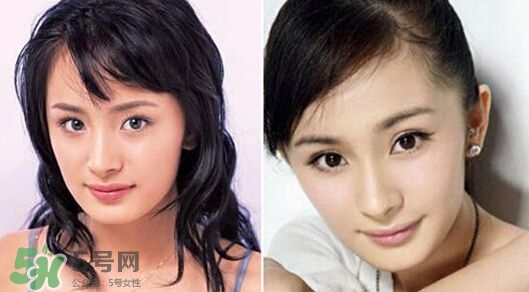 打瘦臉針能懷孕嗎？打瘦臉針能吃避孕藥嗎？