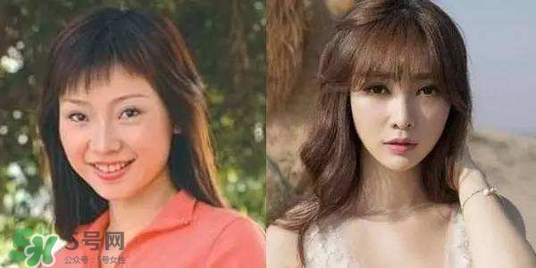 打瘦臉針能懷孕嗎？打瘦臉針能吃避孕藥嗎？