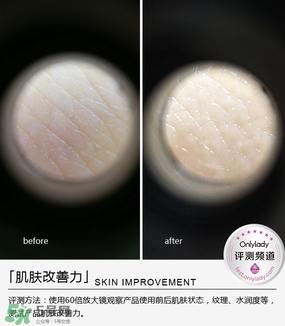 歐萊雅清潤補水精華適合什么年齡？歐萊雅清潤補水精華年齡段