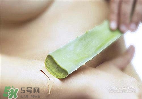 蘆薈涂在臉上發(fā)癢是怎么回事？蘆薈涂在臉上發(fā)癢怎么辦？