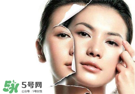 美白針是什么？美白針可以連續(xù)打嗎？