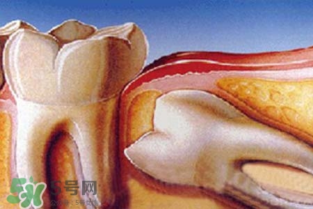 智齒會一直長嗎？智齒會停止生長嗎？