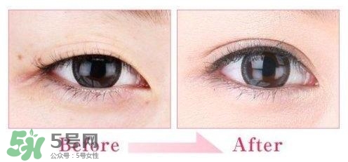 割雙眼皮多少錢(qián)？割雙眼皮最佳年齡