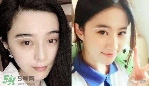 割雙眼皮有幾種做法？雙眼皮有哪幾種形狀？