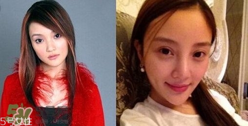 割雙眼皮有幾種做法？雙眼皮有哪幾種形狀？