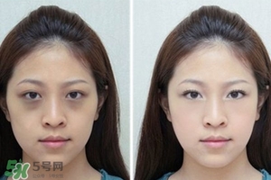 臥蠶是黑眼圈嗎？臥蠶和黑眼圈的區(qū)別