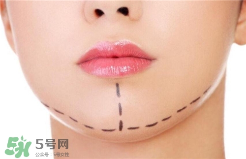 玻尿酸墊下巴能維持多久？玻尿酸墊下巴能維持多長(zhǎng)時(shí)間？