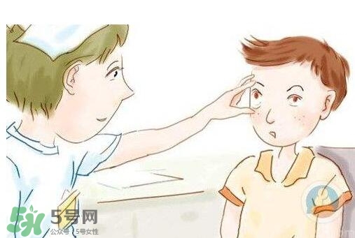 紅眼病用什么眼藥水好？紅眼病吃什么好得快