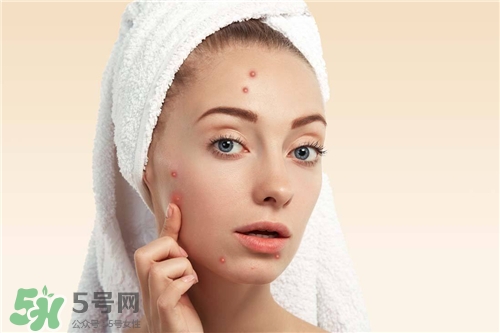 激光祛痘印有副作用嗎？激光去痘印有后遺癥嗎？