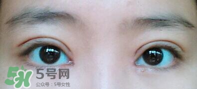 眼角增生會(huì)自動(dòng)恢復(fù)嗎？眼角增生多久可以下去？