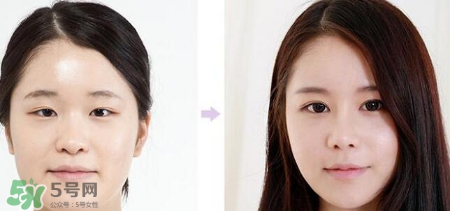 哪些人需要開(kāi)眼角？需要開(kāi)眼角的眼睛圖片