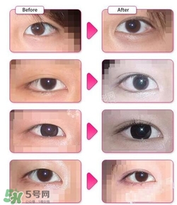 哪些人需要開(kāi)眼角？需要開(kāi)眼角的眼睛圖片