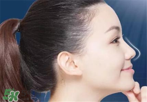 隆鼻會(huì)拉近眼距嗎？隆鼻會(huì)改變眼睛嗎？