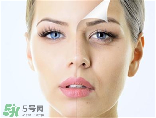 玻尿酸除皺有效果嗎？玻尿酸除皺效果怎么樣？