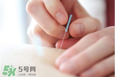 沒病可以針灸嗎？沒病可以扎針嗎？