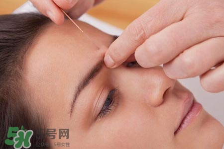 沒病可以針灸嗎？沒病可以扎針嗎？