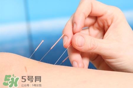 沒病可以針灸嗎？沒病可以扎針嗎？