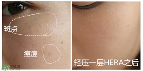 赫拉氣墊用了悶痘嗎？赫拉氣墊悶痘怎么辦？