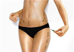 抽脂會(huì)留下疤痕嗎？抽脂會(huì)不會(huì)留疤？