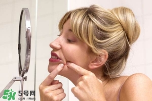 痘印怎么去除 痘印怎么祛除小妙招 痘印怎么去除 痘印怎么祛除小妙招