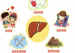 肝炎會傳染嗎？肝炎會不會傳染別人？