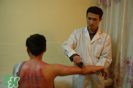 骨質(zhì)疏松可以刮痧嗎？骨質(zhì)疏松刮痧好嗎？