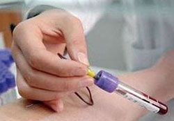 諾如病毒要驗(yàn)血嗎?諾如病毒可以驗(yàn)血查出來嗎?