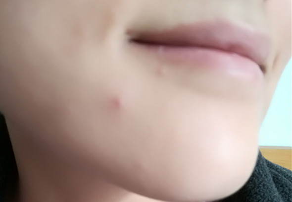 美康粉黛適合什么年齡？美康粉黛適合年齡段