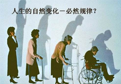 哪些人容易得骨質(zhì)疏松癥？骨質(zhì)疏松的高發(fā)人群有哪些？