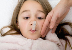 水痘疤痕如何消除？水痘疤痕怎么去除？