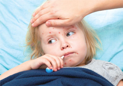 春天容易得水痘嗎？春天是水痘的高發(fā)季節(jié)嗎？