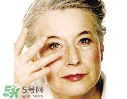 老年斑是怎么形成的？老年斑的形成原因