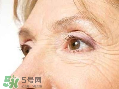 老年斑是怎么形成的？老年斑的形成原因