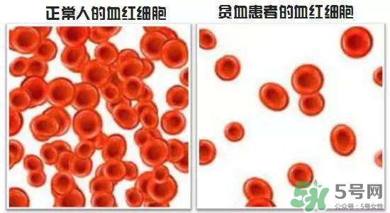 缺鐵性貧血的癥狀 缺鐵性貧血的癥狀有哪些？