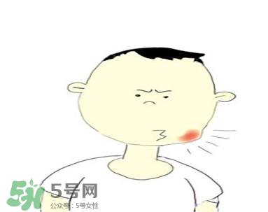 嘴角起泡是什么原因？嘴角起泡怎么辦？