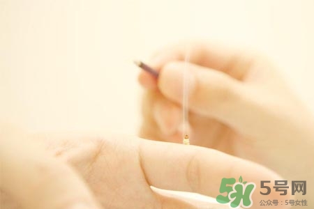 艾灸可以減肥嗎？艾灸減肥的穴位方法介紹