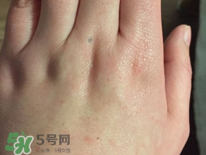 薇諾娜適合什么皮膚？薇諾娜適合敏感肌嗎？